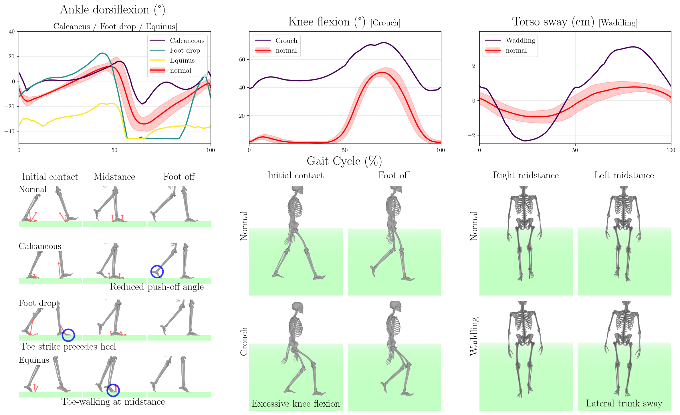 Pathological Gait Optimization Results